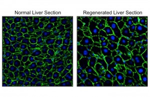 Visualization of nuclei (blue) and outlines (green) of hepatocytes. Hepatocytes in the regenerated liver (right) were significantly larger than those in the normal liver (left). © Yuichiro Miyaoka