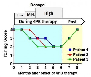 Itching scores in PFIC1 patients (children) during and after 4-phenylbutyrate (4PB) therapy. 