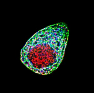 超高解像度蛍光顕微鏡による、膵臓のベータ細胞を守るタンパク質の複合体。KIF12分子モータータンパク質(緑)がストレス制御タンパク質(青)とその転写因子(赤)に結合することで、これらのタンパク質の細胞内の量を維持する。脂肪分をとりすぎるとKIF12の量が下がり、この複合体が崩壊して糖尿病が進行すると示唆された。