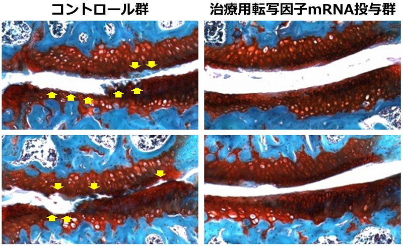 軟骨形成性転写因子のmRNAを関節内に届けることによって、抑えられた変形性関節症の進行 © 2016 Hailati Aini.赤く染まっている部分が関節軟骨。RUNX1 のmRNAを投与していないマウス群で認められる関節軟骨表面のめくれ・変性・摩耗(黄矢印)がRUNX1の mRNAを投与したマウス群では抑えられている。