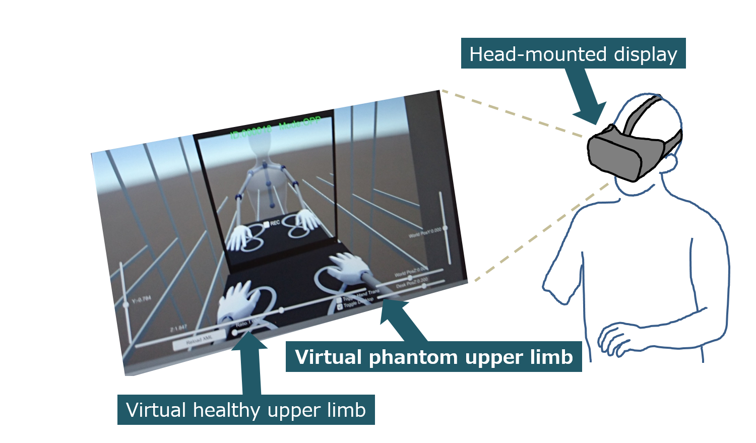 Neurorehabilitation with a virtual reality system