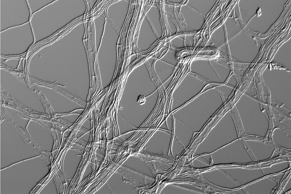 Acremonium egyptiacum fungus filaments under a microscope