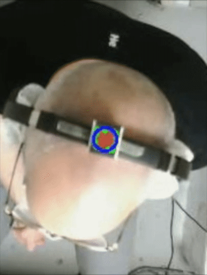 Top down view of an older male seated participant nodding their head while listening to Mozart on headphones with an accelerometer attached.