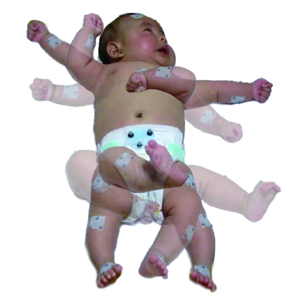 Multilayered image of a baby moving.