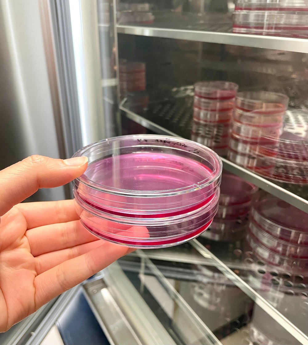 Photo of hand holding petri dish with cell culture