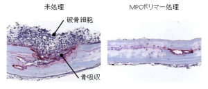 微粒子をマウス骨表面に移植したときの破骨細胞の形成と骨吸収の様子