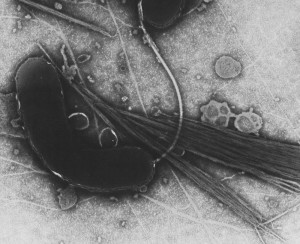 TEM image of Vibrio cholerae