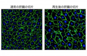肝細胞の核（青色）と輪郭（緑色）を可視化した。肝再生後の肝細胞（右）は、平常時の肝細胞(左)に比較して顕著に大きくなっていた。&copy Yuichiro Miyaoka