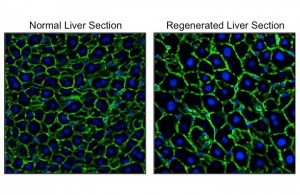 Visualization of nuclei (blue) and outlines (green) of hepatocytes. Hepatocytes in the regenerated liver (right) were significantly larger than those in the normal liver (left). © Yuichiro Miyaoka Visualization of nuclei (blue) and outlines (green) of hepatocytes. Hepatocytes in the regenerated liver (right) were significantly larger than those in the normal liver (left). © Yuichiro Miyaoka