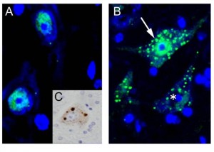Immunohistochemistry for TDP-43 on the spinal cord of conditional knockout mice for ADAR2 (AR2), an RNA editing enzyme.