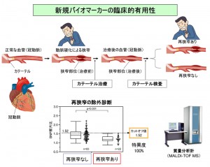 © The University of Tokyo Hospital. All Rights Rserved. 図: 新規バイオマーカーの臨床的有用性