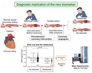© The University of Tokyo Hospital. All Rights Rserved. Figure: Diagnostic implications of the new biomarker