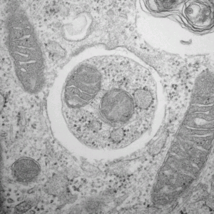 Cytoplasmic components surrounded by an autophagosome