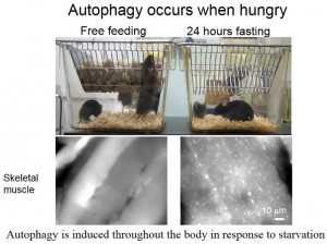 The glowing-autophagosome mouse model created by Professor Mizushima and provided to researchers around the world.