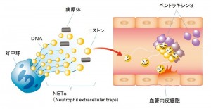 細胞外ヒストンの血管傷害活性とペントラキシン3(PTX3)の保護作用 細胞外ヒストンの血管傷害活性とペントラキシン3(PTX3)の保護作用。重症感染症では好中球から病原体に向けて放出されるNETs(Neutrophil extracellular traps)あるいは、傷害された細胞から漏出したヒストンが細胞外ヒストンとして血中に増え、血管内皮細胞を傷害し、臓器不全に至る。ペントラキシン3は、ヒストンを凝集させて内皮細胞を保護する作用がある。
