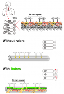 Upper left: Cilia are present in the human trachea in order to discharge foreign bodies as sputum. Top right: fine three-dimensional structure of cilia taken by cryo-electron tomography. The 96-nanometer periodic structure is visible. Bottom: If there is no nano-molecular ruler, a repeating structure is not formed and cilia are immotile. When the molecular ruler is present, dynein motor proteins are aligned in accordance with the ruler’s 96-nanometer period and the cilia are motile.
