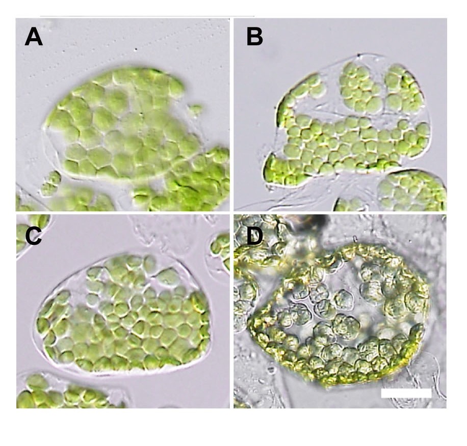 © 2015　岡崎　久美子植物の細胞の中の葉緑体は無処理の場合（A）に比べ、PI4Pの合成阻害剤で処理した場合（B、C）では細胞一個当たりの葉緑体の数が増える一方、大きさが小さくなっていた。PI4Pと同じホスホイノシタイドの仲間であるPI3Pの合成阻害剤で処理した場合（D）では、葉緑体の数や大きさは無処理の場合とほとんど変わらなかった。右下白色のスケールバーは10マイクロメートル。