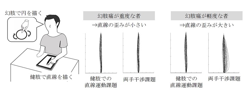©  2015 Michihiro Osumi.実験参加者は健康な手で直線を描きながら幻肢で円を描くように指示されます。幻肢痛が重度な者は健康な手で描く直線が歪まず、幻肢痛が軽度な者は健康な手で描く直線が歪みます。幻肢をはっきりと運かせる者は幻肢痛が軽度であることがわかりました。