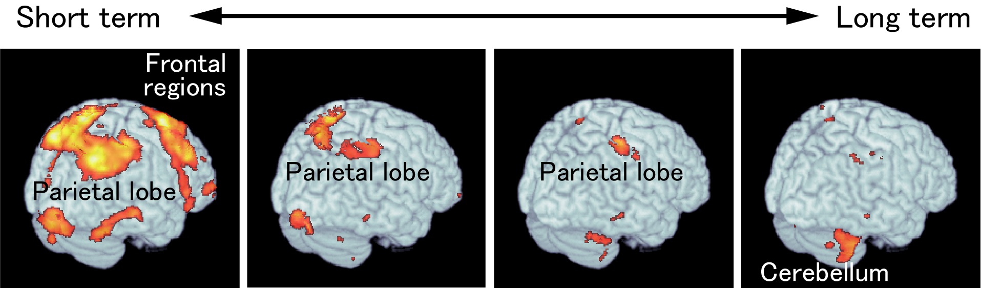 Long Term Memory Brain