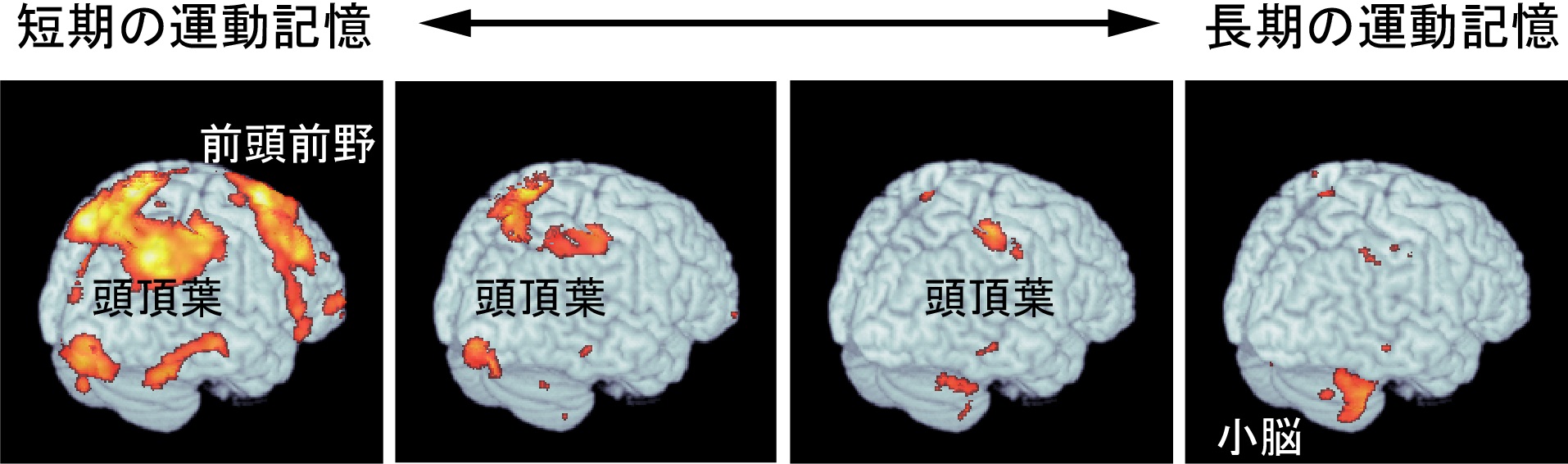 © 2015 今水　寛脳を右斜め後ろから見た図。練習時間が増えるにつれて、左の図から右の図へと運動記憶に関係する脳の場所が変わる。