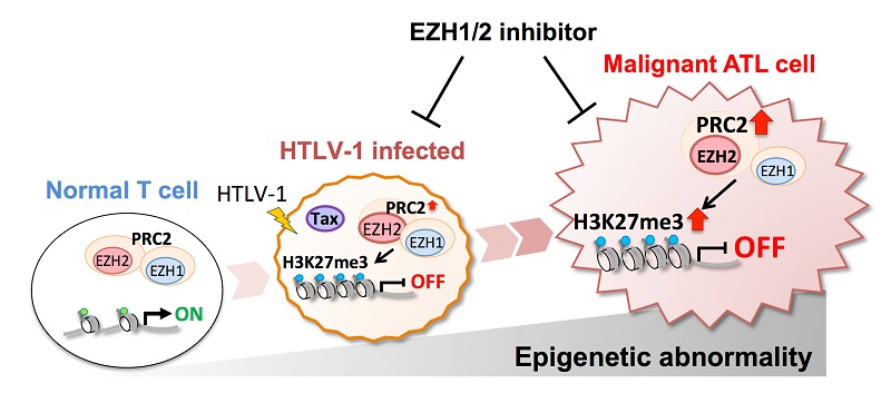 Epigenetic landscape of ATL development from HTLV-1 infection to accumulation of epigenome disorder © 2016 Makoto Yamagishi.When T-cells are infected with HTLV-1, inappropriate histone methylation is carried out by the histone methylation enzymes EZH1/2. This epigenetic abnormality increases in extent and scope with the malignant transformation of T cells.