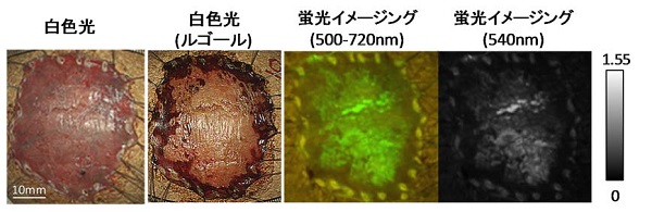 蛍光試薬を用いた癌の検出 © 2016 小野山 温那肉眼では、癌の範囲は不明瞭です(左図)。ルゴールという特別な色素をスプレーすると、癌のない部分は茶色く染まりますが、癌の部分は染まりません(左から2番目)。臨床の現場ではこの色素を使って癌をみつけています。ただし、この色素は刺激性が非常に強く、苦痛を伴う検査になってしまいます。一方、蛍光試薬を散布した10分後の画像(右から2番目と右図)では、はっきりと緑色の蛍光が得られます。この蛍光試薬はルゴールとは異なり、刺激性をほとんどもたないため、苦痛のない検査が受けられます。