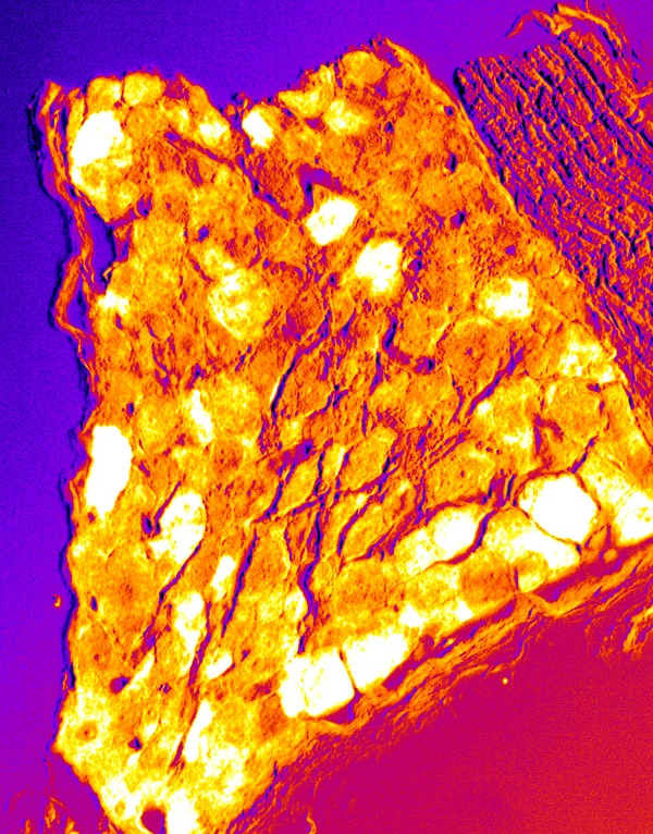 Pain neurons in the dorsal root ganglion © 2016 Yosuke Tanaka & Nobutaka Hirokawa.Pain sensory neurons (white cells in pseudocolor) are labeled with an anti-TrkA antibody (immunohistochemistry) in a paraffin section of the dorsal root ganglion of a laboratory mouse. Pain neurons extend axons from these cell bodies to both the skin in the periphery and to the spinal cord. These neurons sense pain depending on KIF1A activity and transmit that information to the central nervous system.