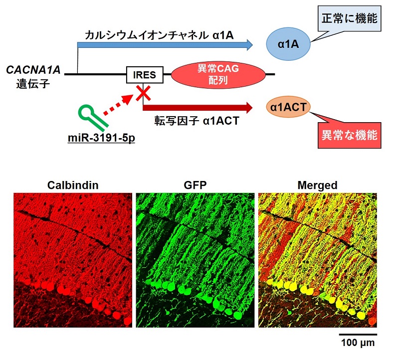 © 2016 Yu Miyazaki.上段：miRNA（miR-3191-5p）によりα1ACTの翻訳のみが阻害され、カルシウムチャンネルα1Aの産生は保たれる。
下段：緑色蛍光タンパク質（GFP）とmiR-3191-5pを共に発現するアデノ随伴ウイルスベクターを投与したマウス小脳の蛍光免疫染色画像。小脳内の神経細胞（Purkinje細胞）を認識する calbindin抗体とGFP抗体を用いて染色した。