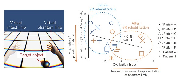 Rehabilitation for phantom limb pain using a virtual reality system © 2016 Michihiro Osumi.By undergoing the rehabilitation exercise of moving their virtual phantom limb and touching the target object in the picture, patients not only saw their movement representations improve, but their phantom limb pain also abate as a result of the improvement.
