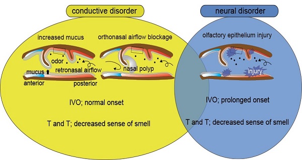 IVO test-based classification of olfactory disorders in patients with chronic rhinosinusitis (CRS) © 2016 Shu Kikuta.Cases with normal onset latency in the IVO test but decreased sense of smell in the T and T olfactory sense test correspond to the type without neural disorder (or conductive disorder only). Conversely, cases with prolonged onset latency in the IVO test, and decreased sense of smell in the T and T test, would correspond to the type with neural disorder.