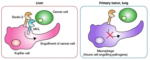 Mechanism by which Dectin 2promotes removal of cancer cells by Kupffer cells © 2016 Yoshitaka Kimura.Dectin-2 promotes phagocytosis of cancer cells by Kupffer cells, working in tandem with MCLto ward off liver metastasis.. On the other hand, tumors found at the site where they originated (primary tumors) and lung metastasis do not trigger such immune response.