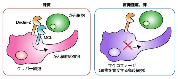 Dectin-2受容体によってクッパー細胞ががん細胞を除去する仕組み © 2016 木村好孝Dectin-2はMCLと協調して、クッパー細胞のがん細胞に対する貪食を促すことで肝転移を抑える。一方、転移していない腫瘍(原発腫瘍)や肺転移ではこのような免疫応答は起こらない。