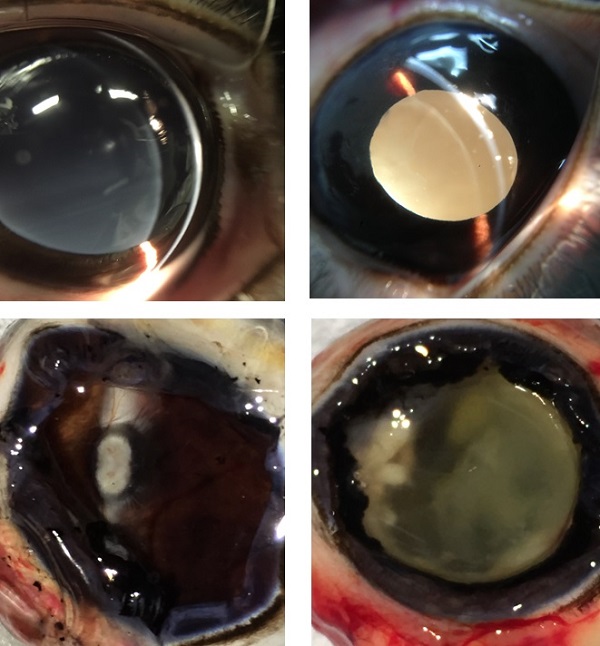New hydrogel (left) and conventional gel (right) administered to rabbits’ eyes © 2017 Takamasa Sakai.The oligo-TetraPEG hydrogel remains transparent, while conventional gels turn opaque due to the inflammation over time. Scientists demonstrated the long-term safety of the hydrogel, which was injected into rabbit eyes after removal of their vitreous, and observing no side effects or rejection by the body for over a year. The researchers also successfully treated retinal detachment by injecting the gel into rabbit eyes.