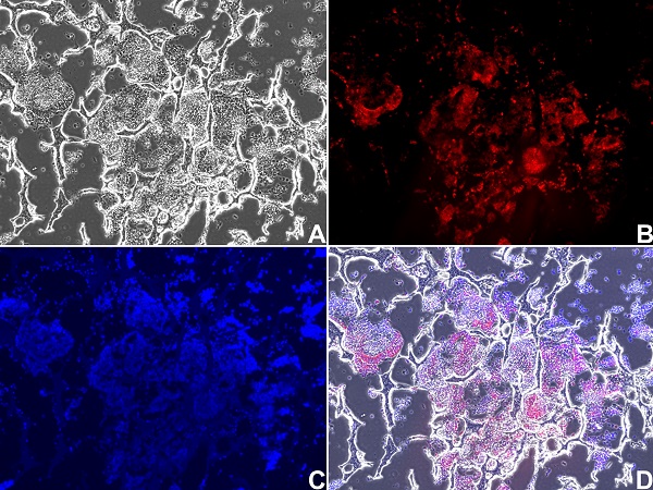 © 2017 Shinsuke Ohba.(A) Phase-contrast image of cells aggregating within pores of the scaffold; (B) expression of SP7, an osteoblast marker, shown in red; cells within pores are SP7-positive osteoblasts; (C) nuclear staining with blue; (D) overlay image of figures A, B, C
