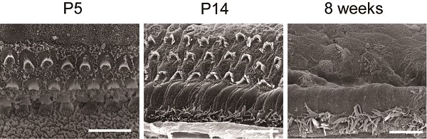 Scanning electron microscopy of Atg5-deficient hair cells © 2017 Chisato Fujimoto.Atg5-deficient hair cells show progressive damage after postnatal day 14 (P14). Scale bar represents 10 microns.