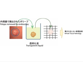 Pathological Diagnosis Technology for the Reliable Detection of Lesions, Junji Yumoto, Director, Research Institute for Photon Science and Laser Technology