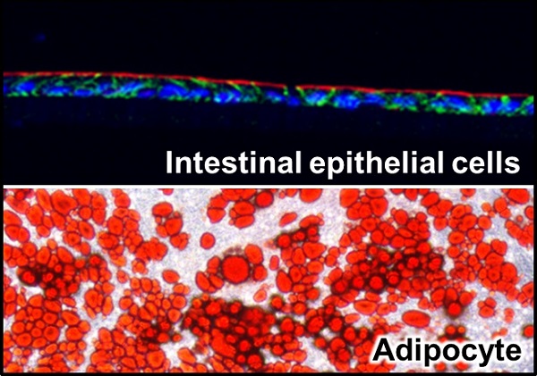 Co-culture of intestinal epithelial cells with adipocytes © 2018 Yu Takahashi.The research group found that intestinal epithelial cells (top), prepared from intestinal tissue-like structures cultured outside the body, called organoids, and adipocytes (bottom), differentiated from mouse embryonic fibroblasts, induced a vicious inflammatory cycle when grown in the same medium—secretions from mature adipocytes trigger inflammation of the intestinal epithelial cells, and subsequently, secretions from inflamed epithelial cells induce inflammation of adipocytes. Inflammatory responses on both cells are believed to occur in a positive feedback cyclical manner.
