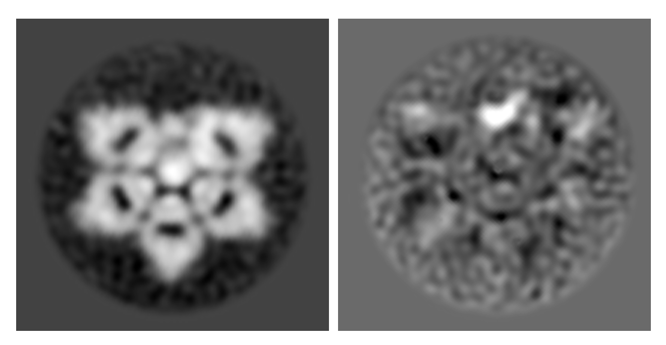 Black-and-white electron microscopy images showing structure of AIM and immune protein IgM