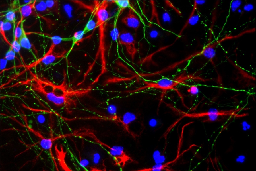 Fluorescent microscopy image of mouse neurons (green), astrocytes (red), and nuclei of the cells (blue).