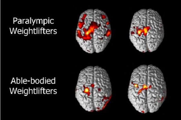 Functional Magnetic Resonance Imaging brain scans of two Paralympic weightlifters showing larger areas of activity than two able-bodied weightlifters.