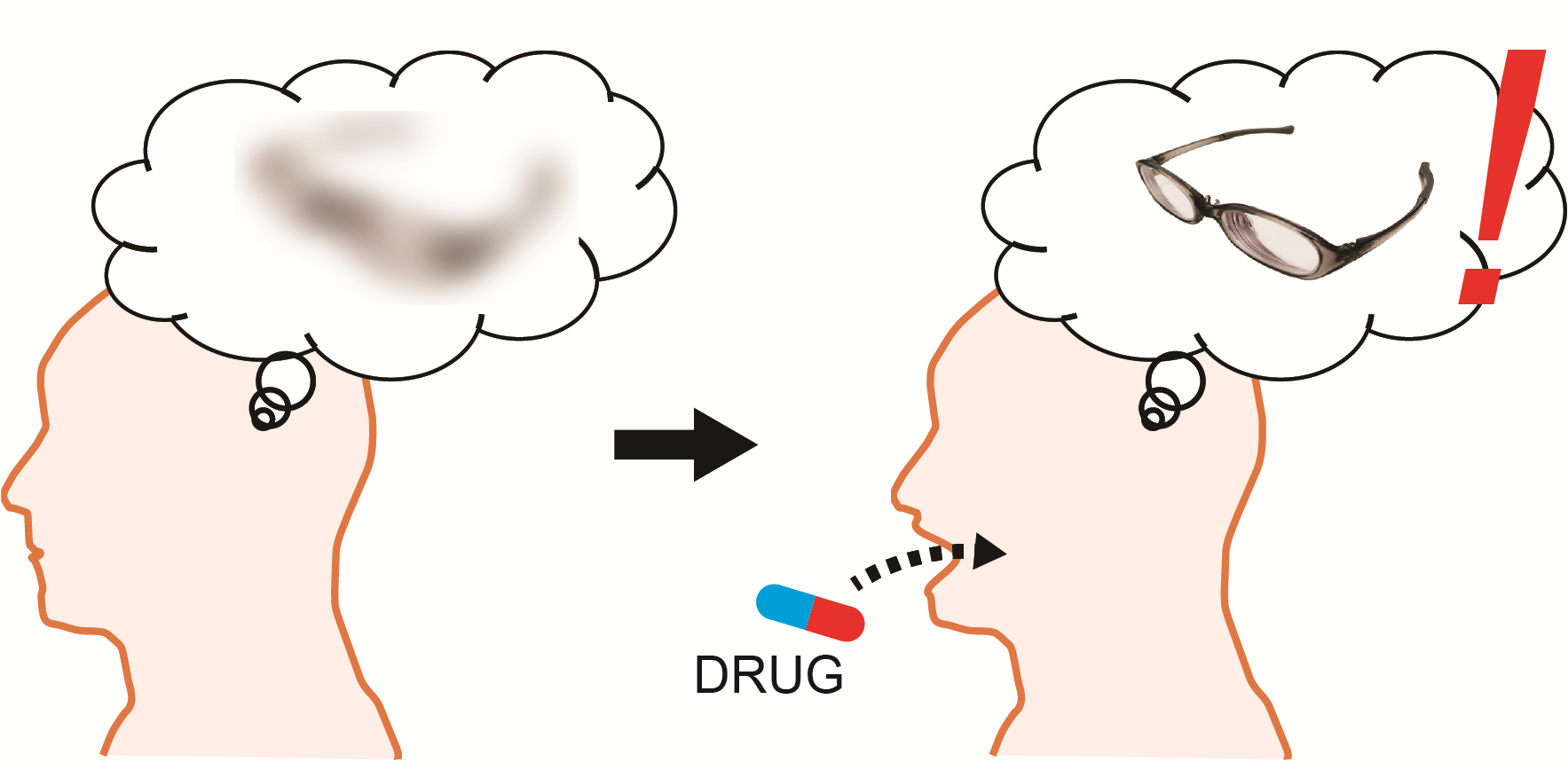 An illustration of a person on the left with a thought cloud containing a fuzzy object and a person on the right taking a pill with a thought cloud containing a clear image of a pair of glasses