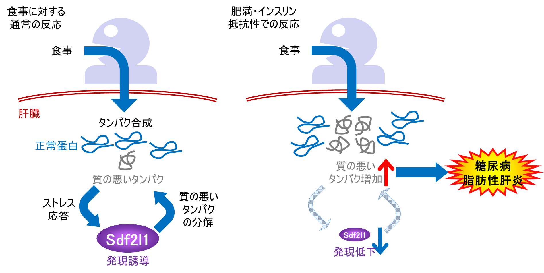 糖尿病 脂肪性肝炎の新たな発症機序の解明 東京大学