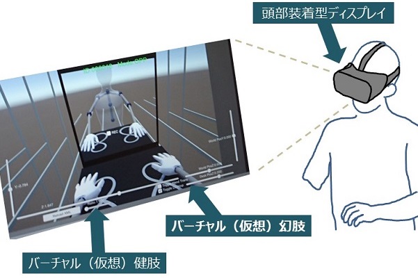 失った手足の痛みを感じる仕組み