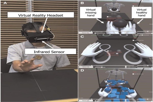Neurorehabilitation with a virtual reality system