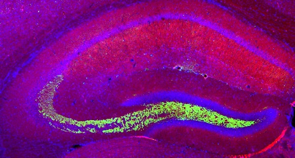 Fluorescent microscopy image showing a health mouse hippocampus.