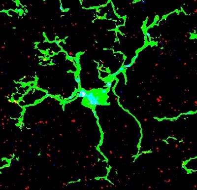 Fluorescent microscopy image of a mouse microglial cell.