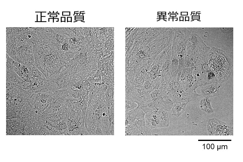 人工知能を用いたヒトips由来細胞培養の品質管理法の開発 東京大学