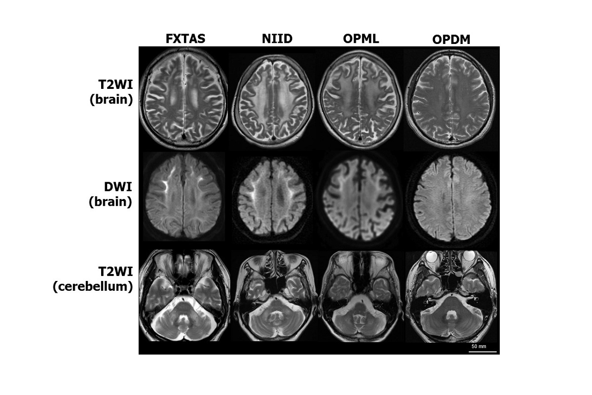MRI brain scans used in the research.