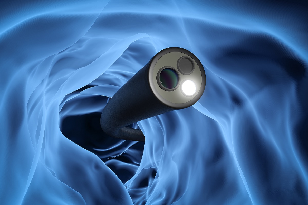 A tube-shaped camera appears in a blue and white tunnel. This image is an artistic illustration of a colonoscopy.