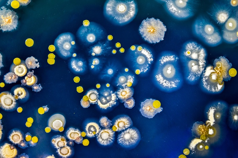 Bacterial colony grown on agar plate culture medium